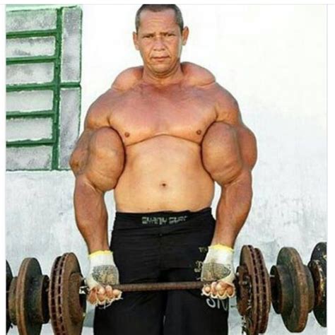 Synthol Infection