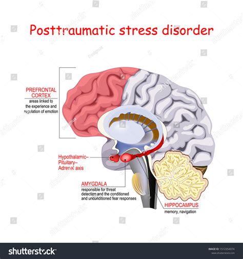 612 Ptsd Brain Images, Stock Photos & Vectors | Shutterstock