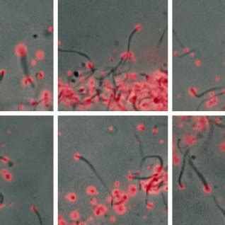 Comet tail formation in vivo induced by fertilization and PMA ...