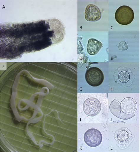 Tapeworm Eggs In Human Poop