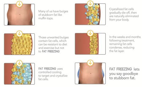 Freezing Fat Cells At Home - Homemade Ftempo