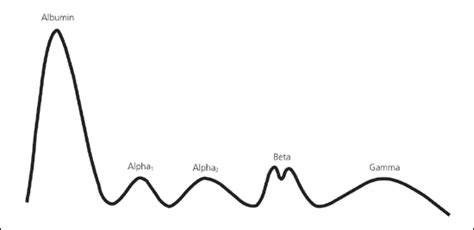 Understanding and Interpreting Serum Protein Electrophoresis | AAFP