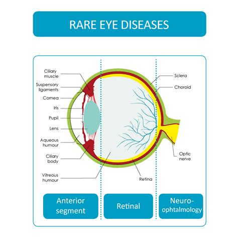 Rare diseases covered by ERN-EYE - ERN-EYE