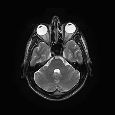 Different Types of Acquired Brain Injury - Brain Injury Law Center