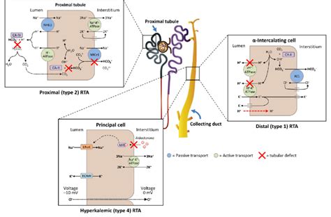 A schematic diagram illustrating the underlying kidney tubule defects... | Download Scientific ...