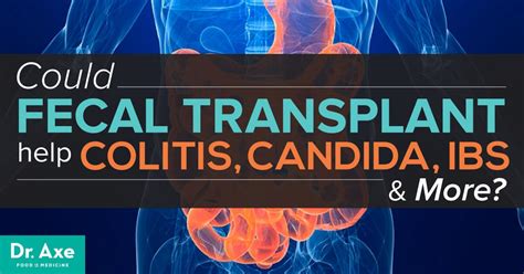 Fecal Transplants for Colitis, Candida and IBS - Dr. Axe