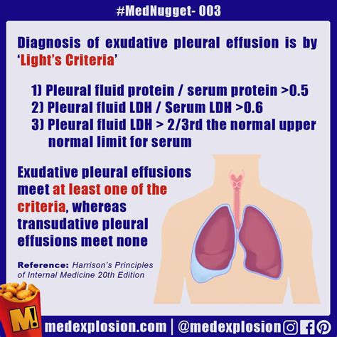 https://img.grepmed.com/uploads/8814/exudate-pleuraleffusion-mednugget ...