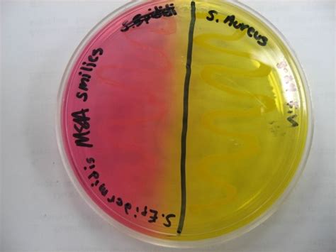 Mannitol salt agar | Microbiology, Microbial, Some image