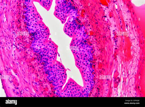 Artery (blood vessel) showing tunica adventitia, media and intima. Optical microscope X200 Stock ...