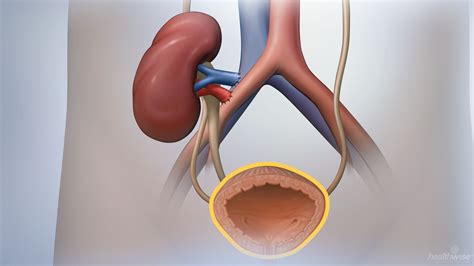 Kidney Transplant