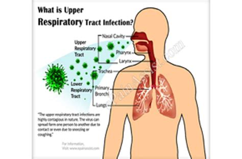 Upper Respiratory Infection