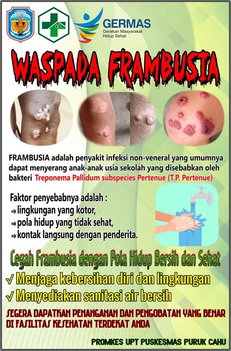 Waspada Frambusia | Pola, Desain