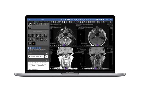 Simplex Pacs Software - Aerorad Medikal