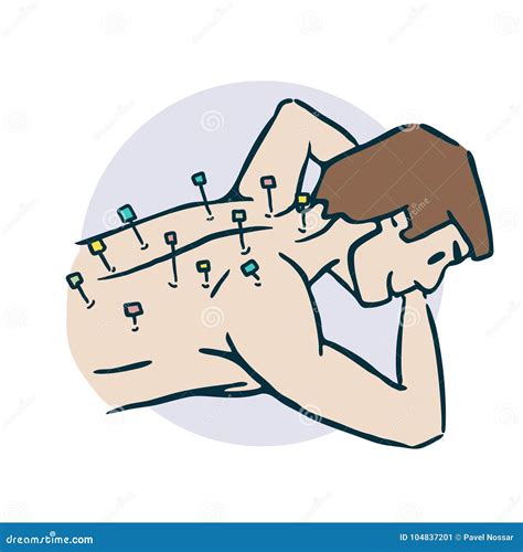 Guy Sticks Needles Acupuncture Stiker Stock Vector - Illustration of ...