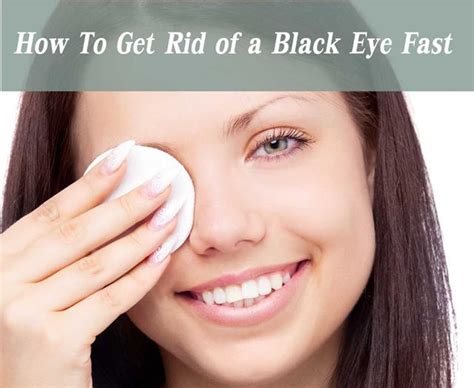 How to Get Rid of a Black Eye Fast