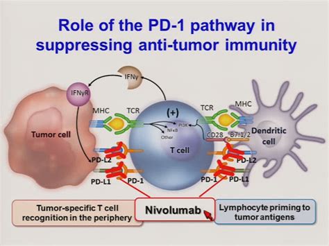 Nivolumab Extends Survival in Pretreated Advanced Stomach Cancer Patients, Phase 3 Trial Results ...