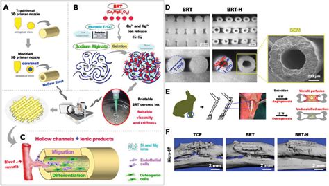 Tissue engineered bone graft using a printable bioceramic ink for long ...