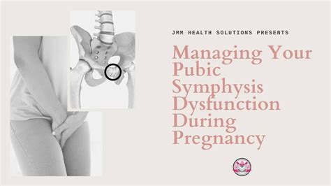 Managing Pubic Symphysis Dysfunction | Irvine Moms