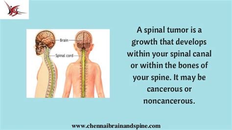 Spinal Cord Tumor Treatment In Chennai | Best Spine Surgery In India