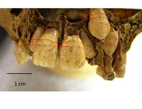 Millions of years of evolutionary history recorded in teeth