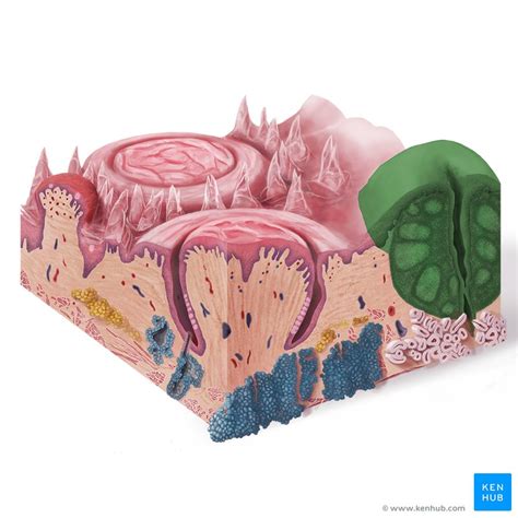 Waldeyer’s Ring: Definition, anatomy and pathology | Kenhub