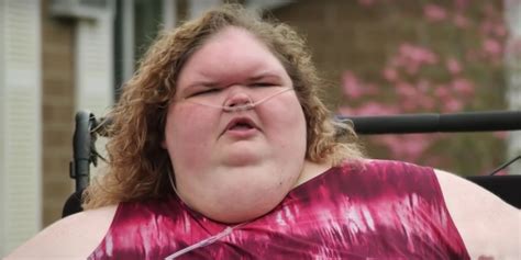 1000-LB Sisters: Why Fans Are Worried About Tammy's Forehead