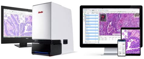 Motic EasyScan FS-Live, Slide Scanner and Microscope for Real-Time Telemicroscopy - Meyer ...