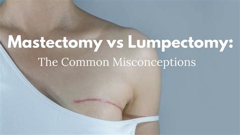 Mastectomy vs Lumpectomy: The Common Misconceptions - YouTube