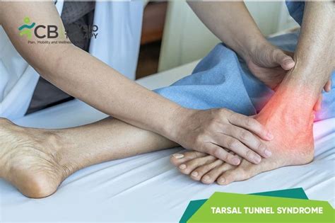 top-5-exercises-for-tarsal-tunnel-syndrome.webp