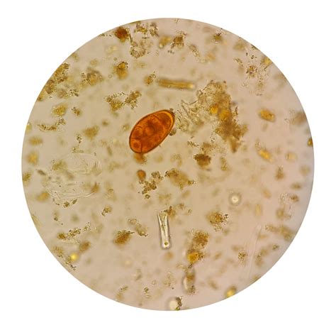 The Pathology Test - Ova, Cysts and Parasites