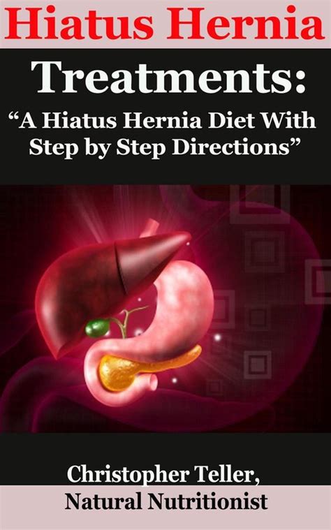 Hiatus Hernia Treatments: A Hiatus Hernia Diet With Step by Step Directions (ebook),... | bol.com