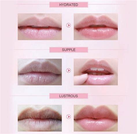 Collagen Lip Mask | Collagen lip mask, Collagen lips, Lip mask