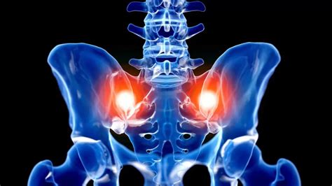 Sacroiliac Joint Injections - Restorative Pain Management