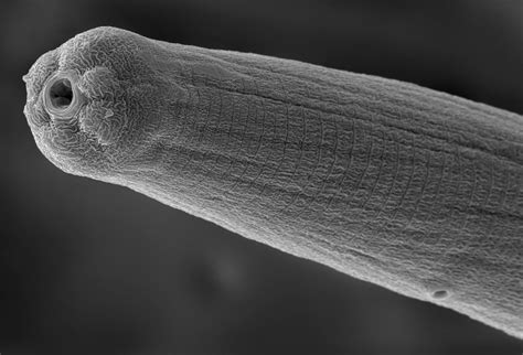 Parasitic worm venom evades human immune system | News