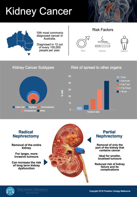 Pathophysiology Of Kidney Cancer