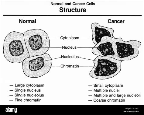 Normal and cancer cells structure Stock Photo - Alamy