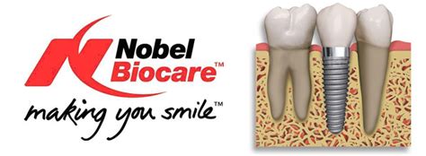 Dental implants Nobel Biocare: prices for implantation in Kyiv, Ukraine ...