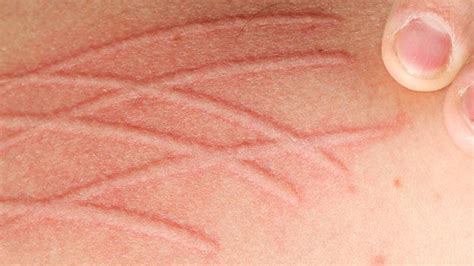 Itching: What’s Causing Your Itchy Skin? (with Pictures)