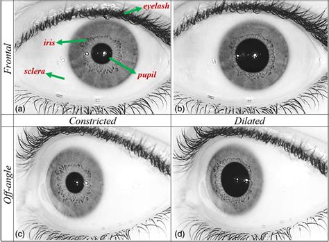 Effect of pupil dilation on off-angle iris recognition