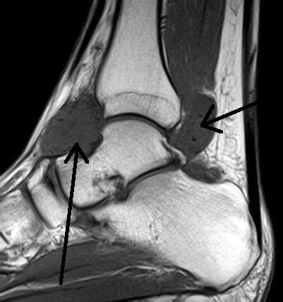 Ankle Anatomy Mri - Anatomical Charts & Posters