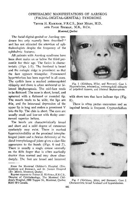 (PDF) Ophthalmic Manifestations of Aarskog (Facial-Digital-Genital ...