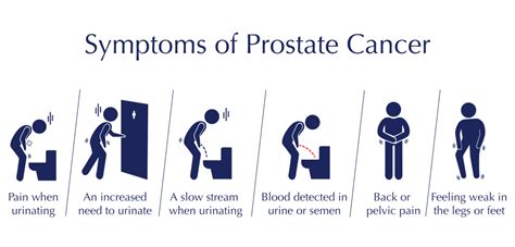 Prostate Cancer Symptoms, Diagnosis & Treatment in Sydney | Katelaris Urology