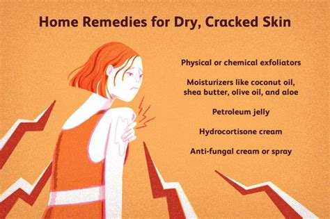 Cracked Skin: Causes, Diagnosis, and Treatment