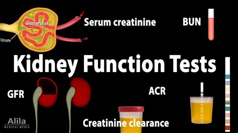 Kidney Function Test Urinalysis Serum Creatinine Bun - vrogue.co