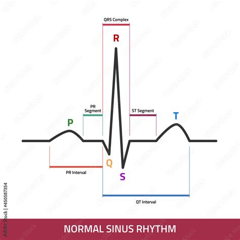 Ecg Of Normal Sinus Rhythm Infographic Diagram Showing Normal Heart | The Best Porn Website