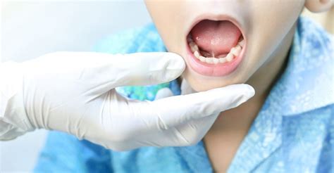 Tongue Tie Treatment: Does Your Child Need Surgery?