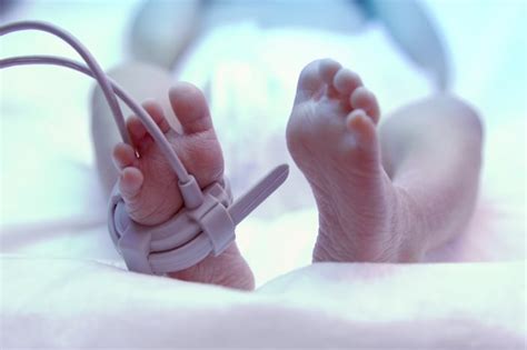 5 Things to Know About Suctioning Newborns