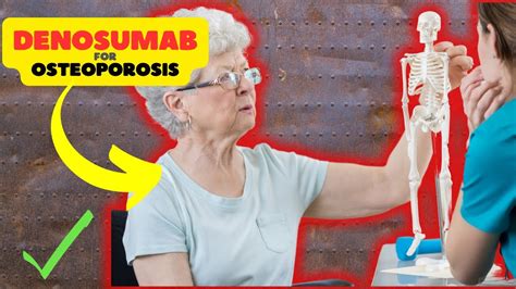 Denosumab injection side effects for osteoporosis - YouTube