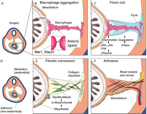 Frontiers | Sterile Injury Repair and Adhesion Formation at Serosal Surfaces