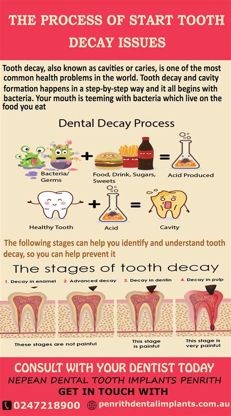 The Start Process of Tooth Decay Issues!!!! Dental tooth decay is the most common problem that ...